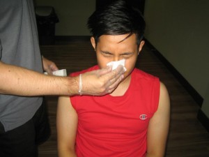 Nose bleeding
